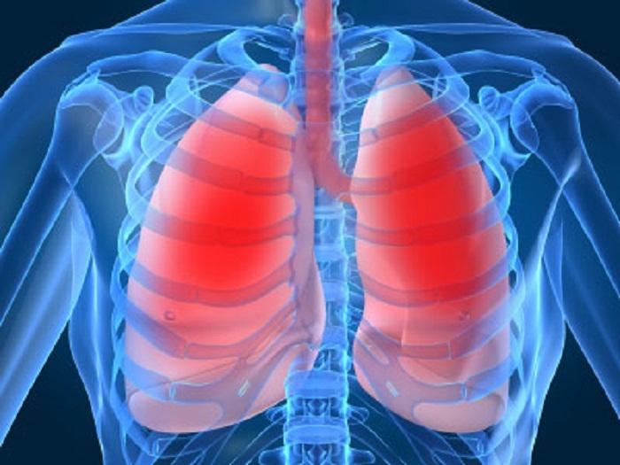 Điều trị tốt các bệnh về phổi
