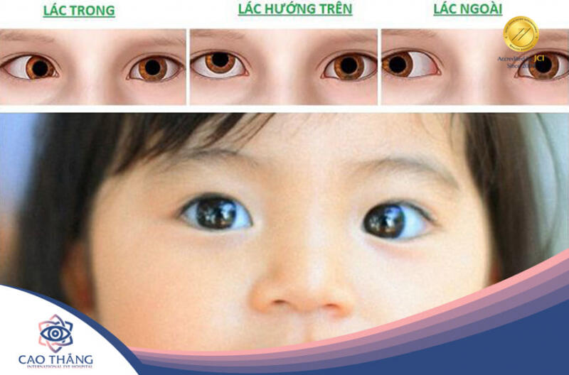 Bệnh viện mắt Cao Thắng