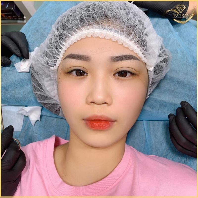 Viện Thẩm Mỹ Quốc Tế Nụ Trần