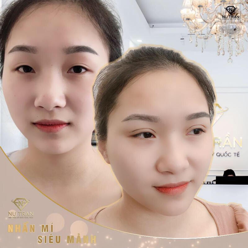 Viện Thẩm Mỹ Quốc Tế Nụ Trần