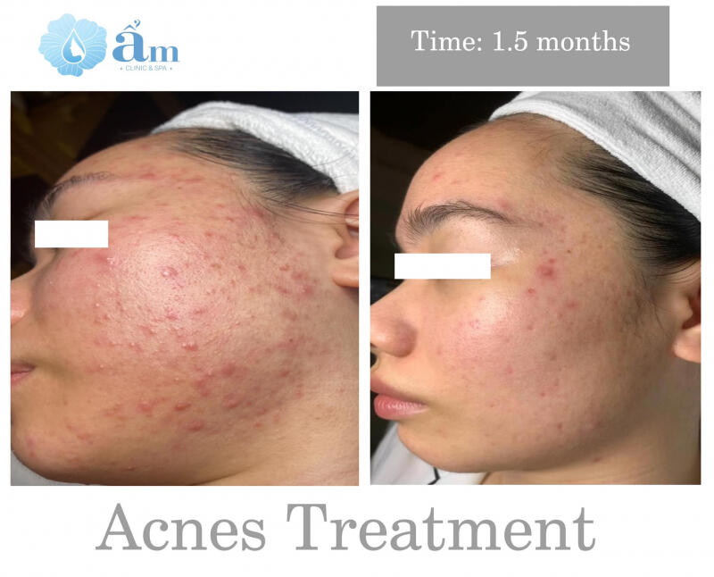 Ẩm Clinic & Spa _ Hải Phòng