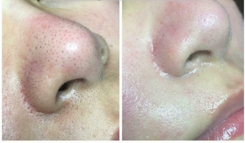 Thúy Thiên Thần Spa