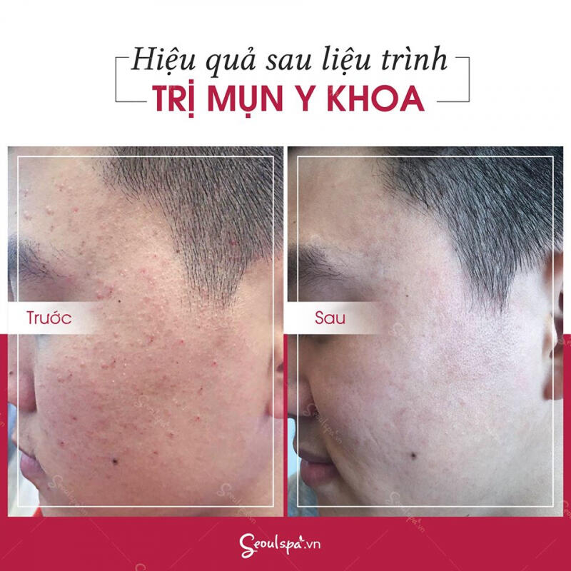 Thẩm Mỹ Viện SeoulSpa.Vn Đà Nẵng