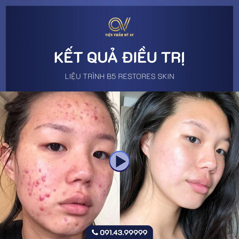 Viện Điều Trị Da Liễu AV Đà Nẵng