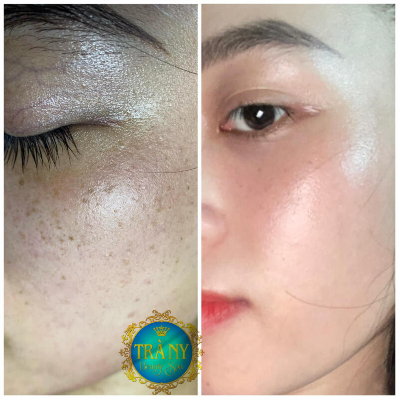 Trà Ny Beauty & Spa