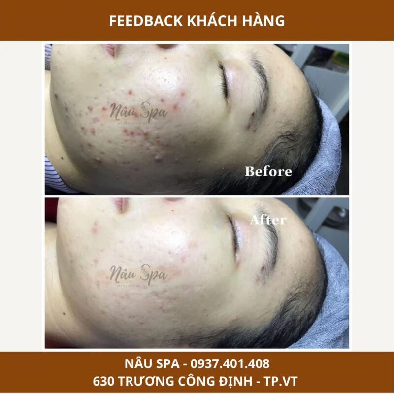 Nâu Spa