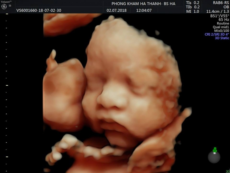 Phòng Khám Phụ Sản Hà Thành