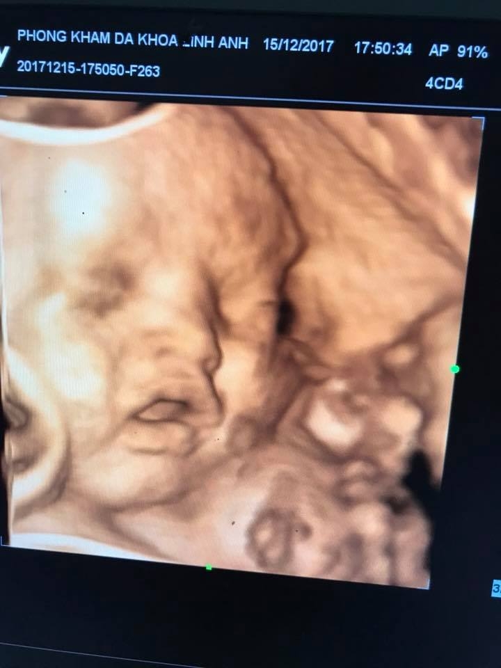 Phòng khám chuyên khoa Linh Anh