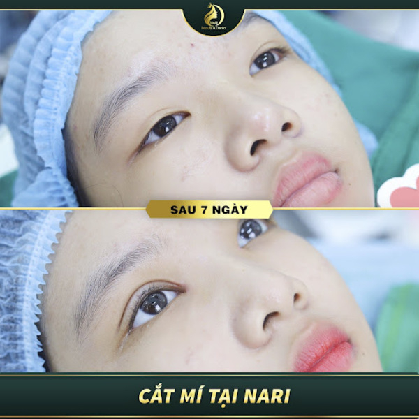 Thẩm mỹ viện Nari