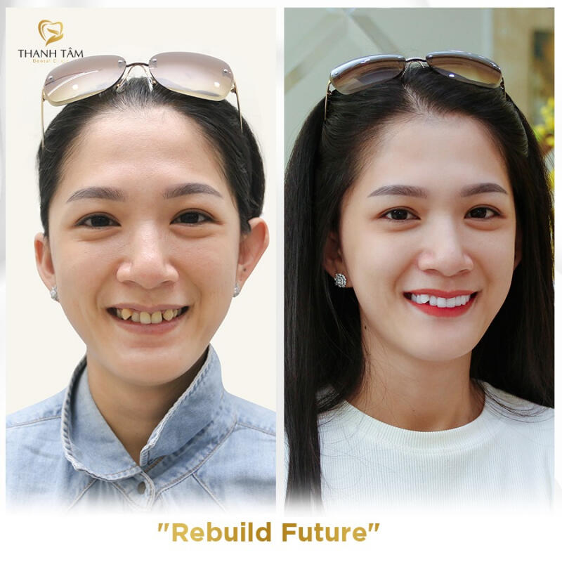 Nha Khoa Thanh Tâm - Chi nhánh Cần Thơ