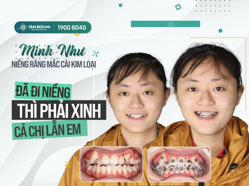 Nha Khoa Tâm Đức Smile