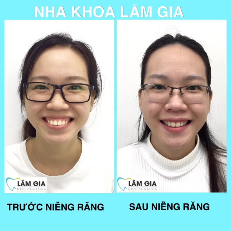 Nha Khoa Lâm Gia