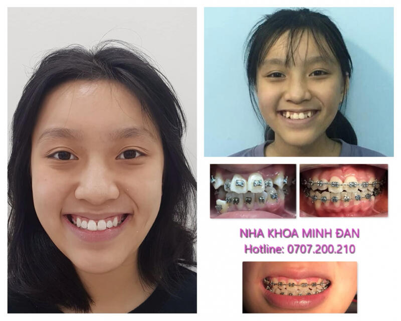 Nha khoa Minh Đan