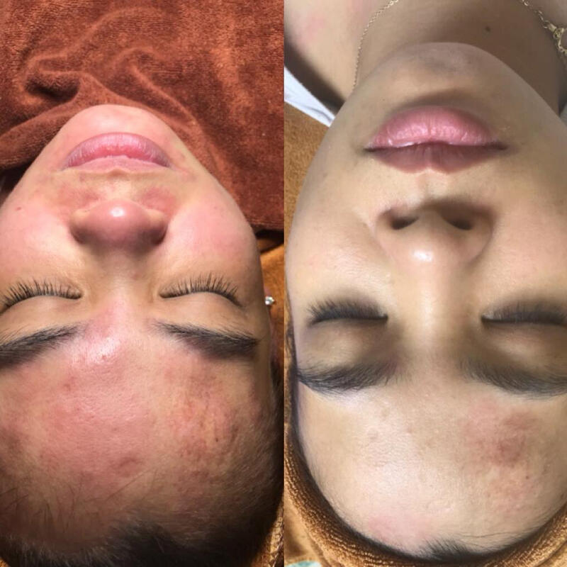 Huệ Spa - Huệ Nguyễn