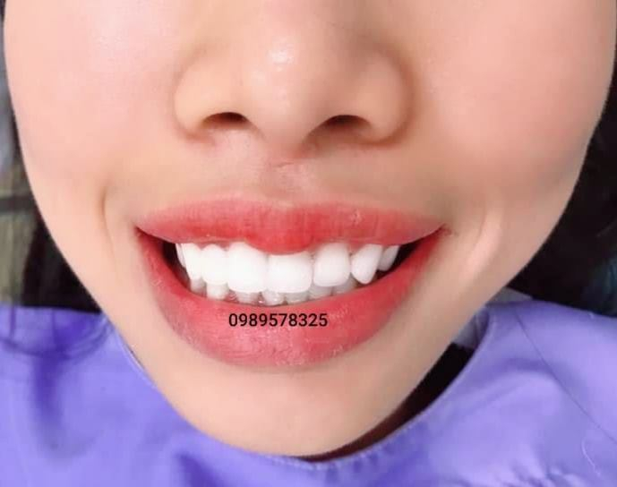 Nha Khoa Đức Hậu